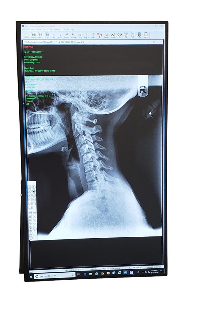 x-ray-mukilteo | Mukilteo Chiropractic Onsite X-Ray